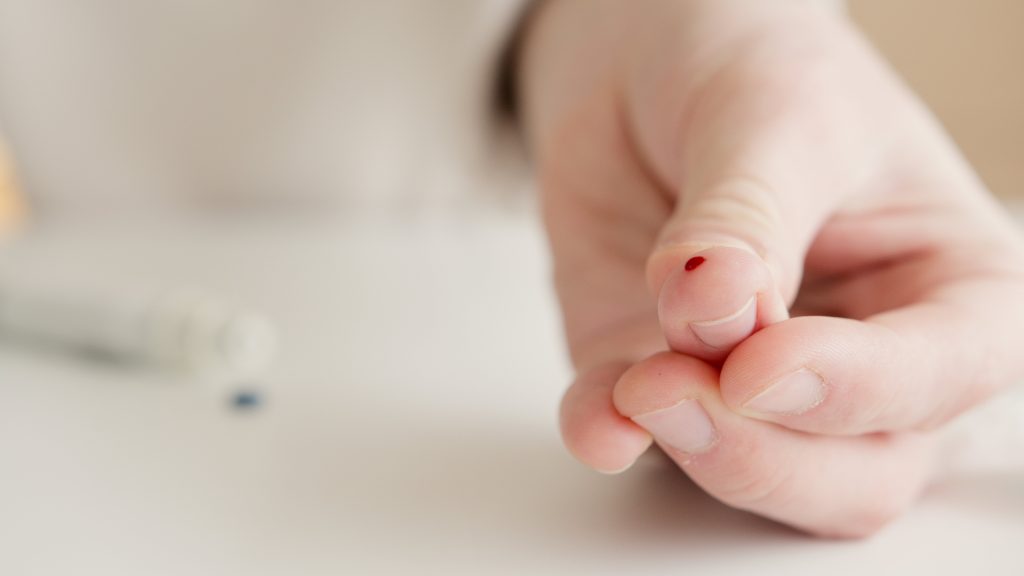 ¿MANCHAS OSCURAS EN LA PIEL? CONOCE LOS SÍNTOMAS MÁS COMUNES DE LA DIABETES